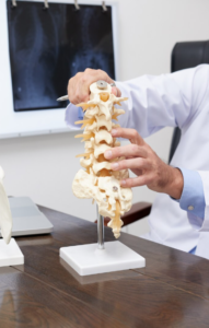 stenoza spinalnog kanala